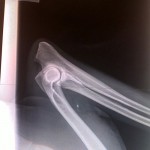 GS Brainpicker elbow x-ray, November 2011
